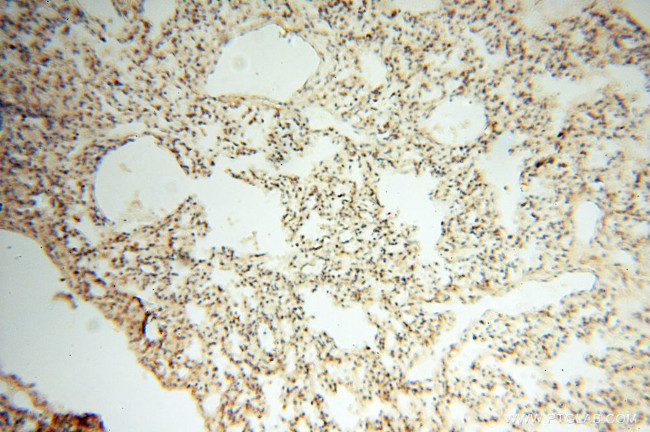 MAT1A Antibody in Immunohistochemistry (Paraffin) (IHC (P))