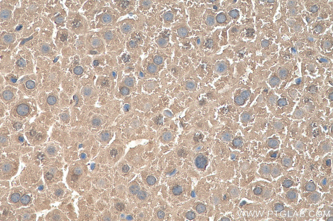 MAT1A Antibody in Immunohistochemistry (Paraffin) (IHC (P))