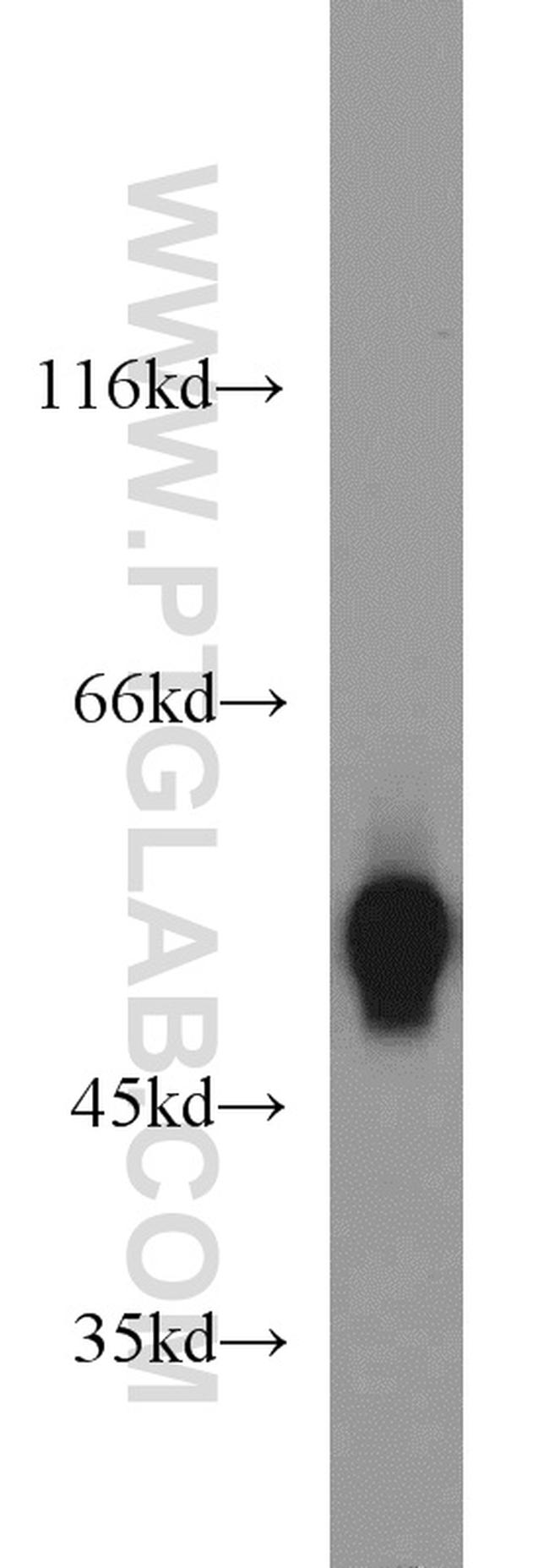 MAT1A Antibody in Western Blot (WB)