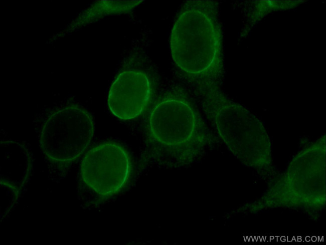 LBR Antibody in Immunocytochemistry (ICC/IF)