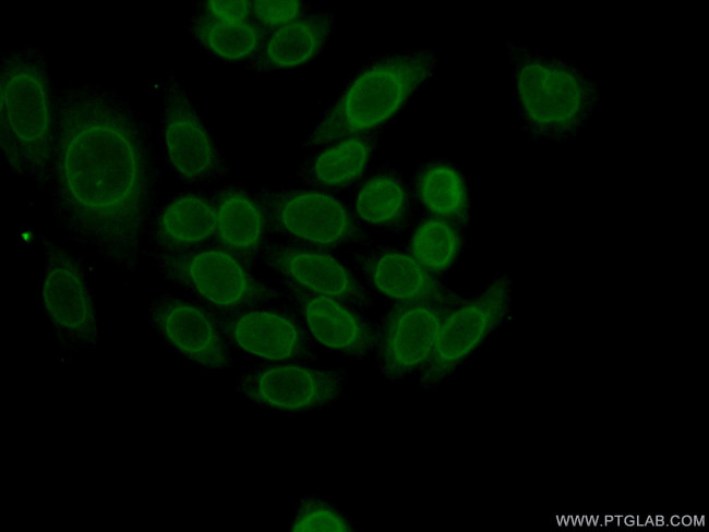 LBR Antibody in Immunocytochemistry (ICC/IF)