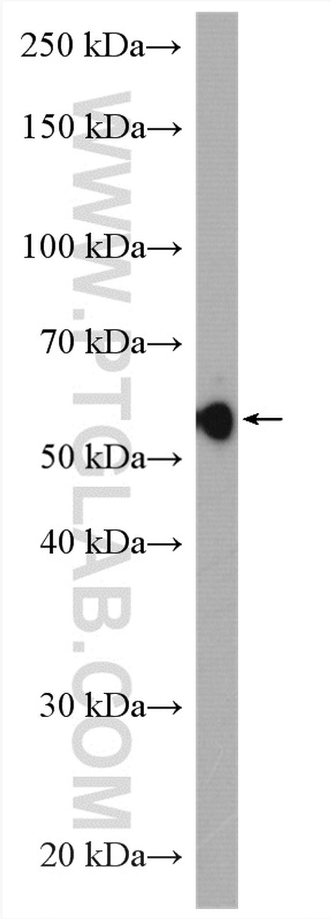 LBR Antibody in Western Blot (WB)