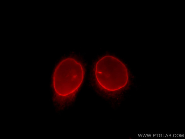 LBR Antibody in Immunocytochemistry (ICC/IF)