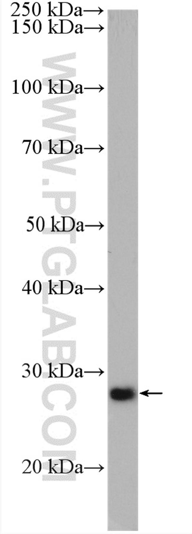 DPM1 Antibody in Western Blot (WB)