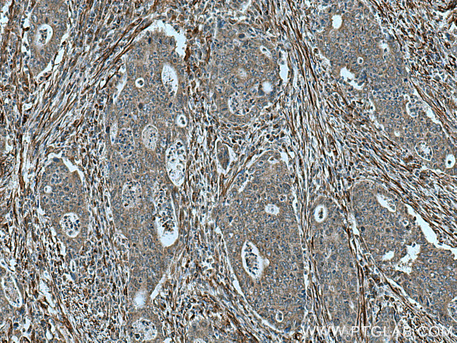 TPST1 Antibody in Immunohistochemistry (Paraffin) (IHC (P))