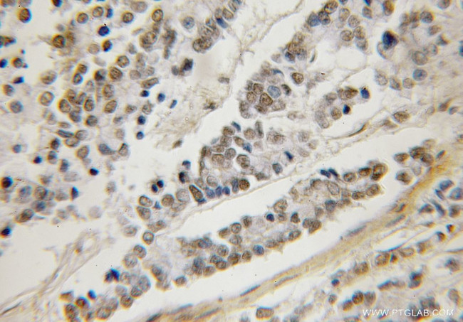 NUP133 Antibody in Immunohistochemistry (Paraffin) (IHC (P))