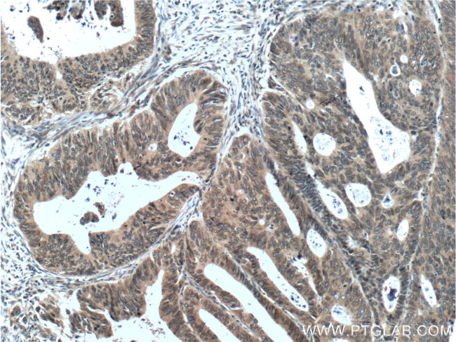 NUP133 Antibody in Immunohistochemistry (Paraffin) (IHC (P))