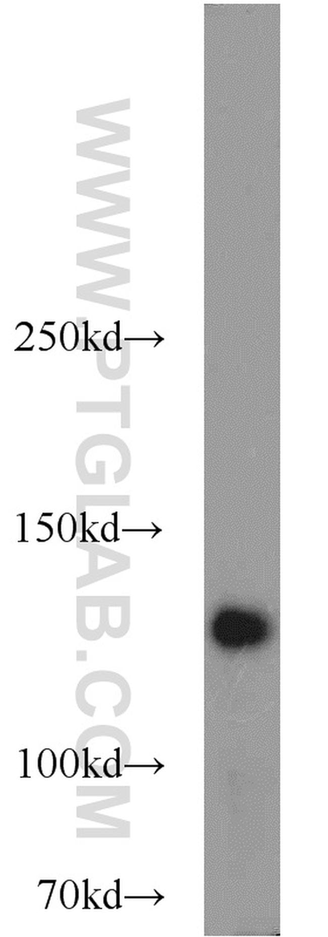 NUP133 Antibody in Western Blot (WB)