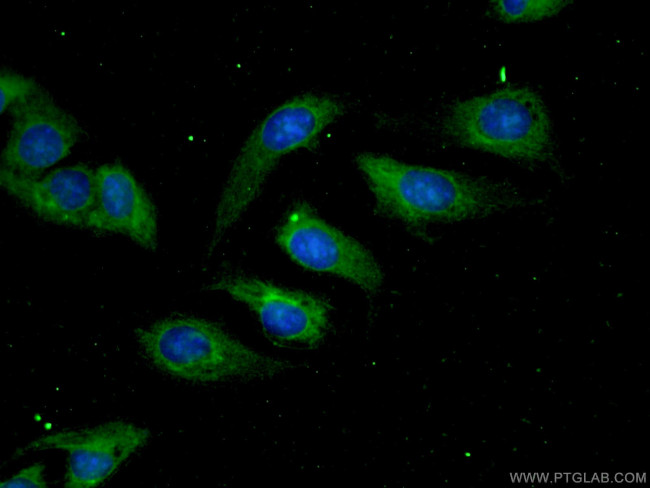 Aconitase 1 Antibody in Immunocytochemistry (ICC/IF)