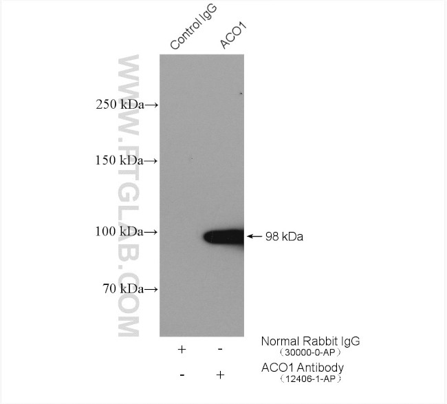 Aconitase 1 Antibody in Immunoprecipitation (IP)