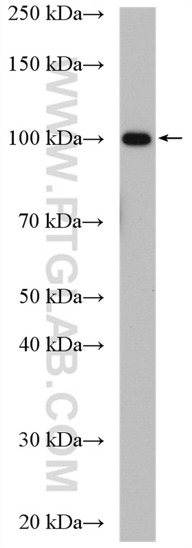 Aconitase 1 Antibody in Western Blot (WB)