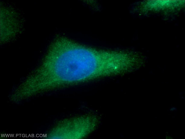 SGCE Antibody in Immunocytochemistry (ICC/IF)