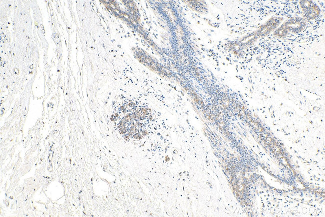 APPBP2 Antibody in Immunohistochemistry (Paraffin) (IHC (P))