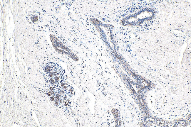 APPBP2 Antibody in Immunohistochemistry (Paraffin) (IHC (P))