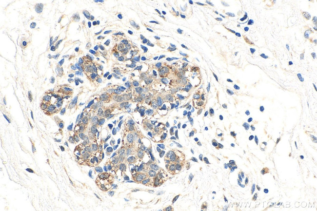 APPBP2 Antibody in Immunohistochemistry (Paraffin) (IHC (P))