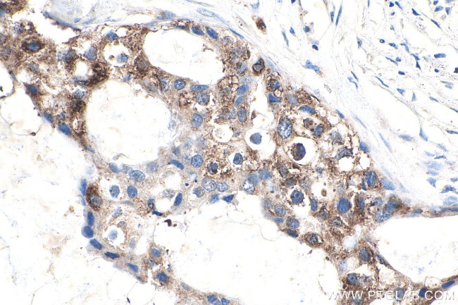 APPBP2 Antibody in Immunohistochemistry (Paraffin) (IHC (P))