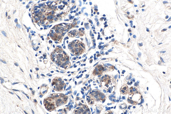 APPBP2 Antibody in Immunohistochemistry (Paraffin) (IHC (P))