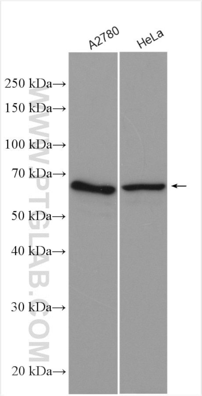 APPBP2 Antibody in Western Blot (WB)