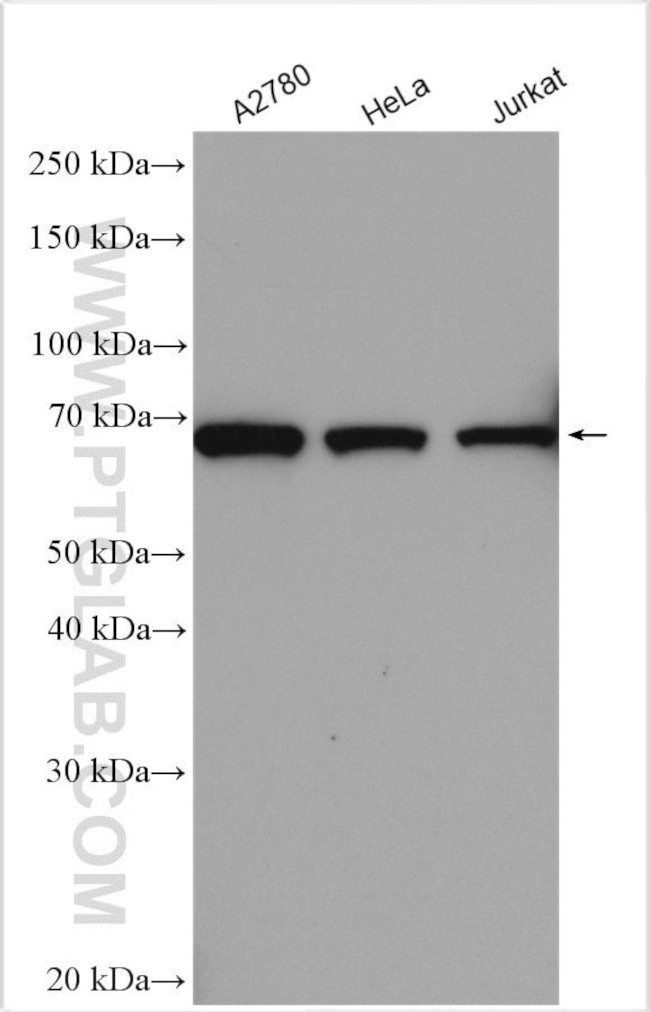 APPBP2 Antibody in Western Blot (WB)