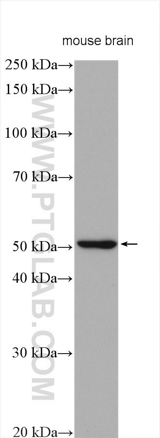 GABRA1 Antibody in Western Blot (WB)