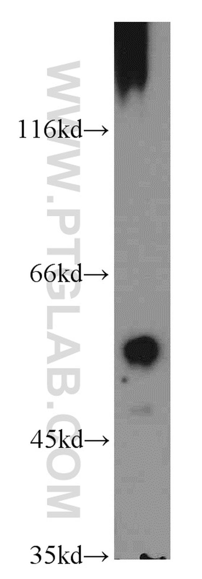 GABRA1 Antibody in Western Blot (WB)