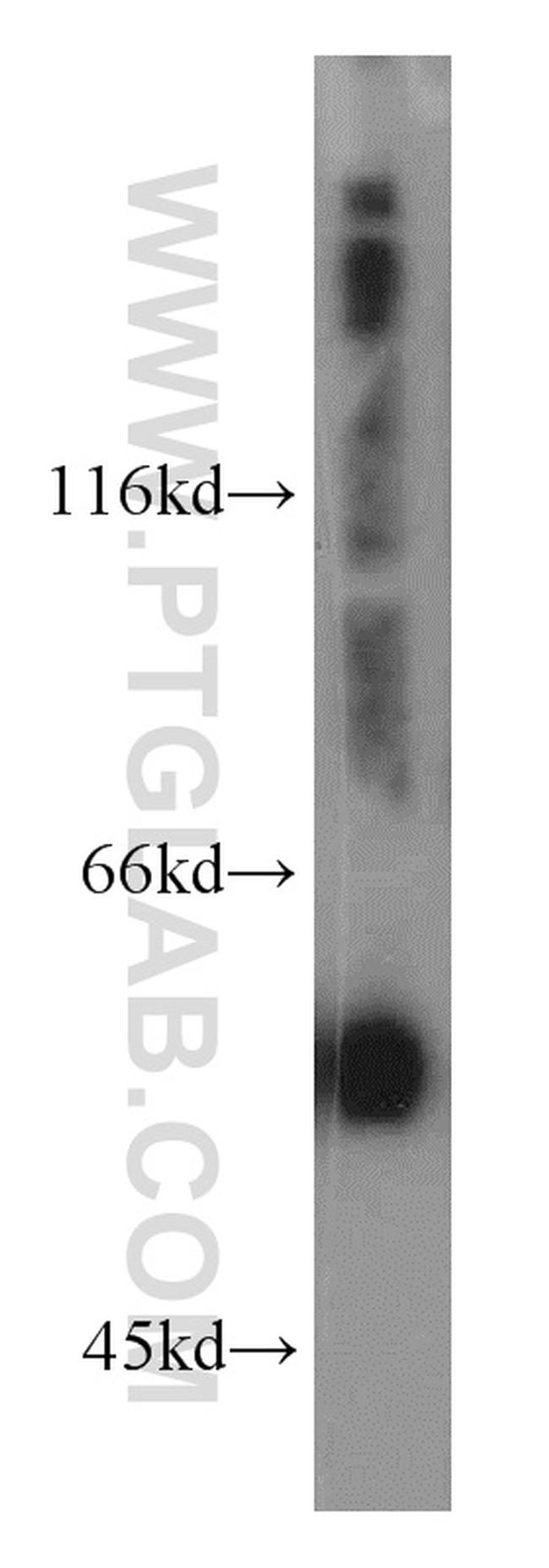 GABRA1 Antibody in Western Blot (WB)