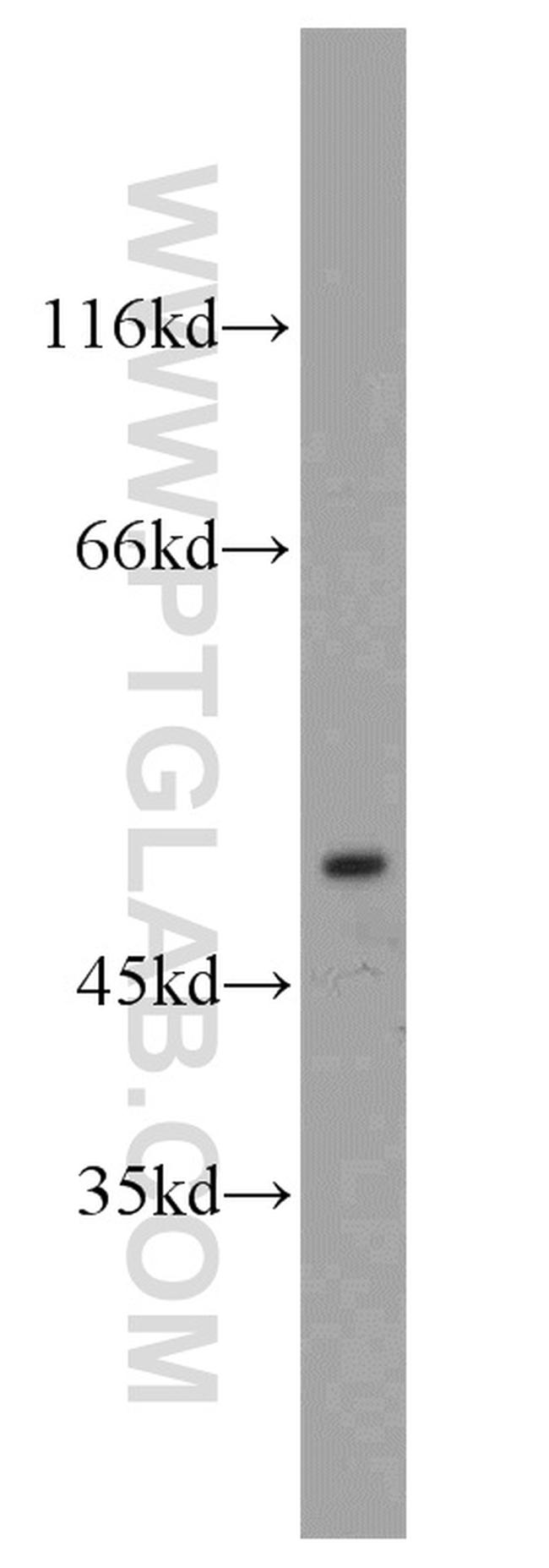 GABRA1 Antibody in Western Blot (WB)