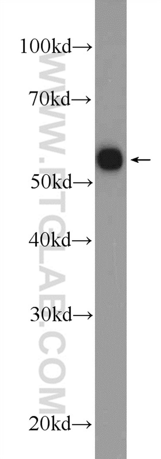 GABRA1 Antibody in Western Blot (WB)