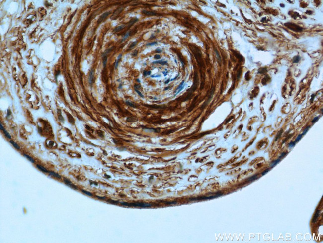 PI4KA Antibody in Immunohistochemistry (Paraffin) (IHC (P))