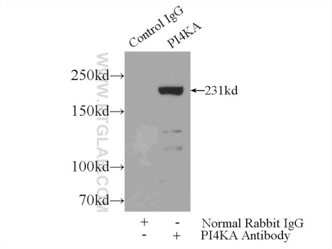 PI4KA Antibody in Immunoprecipitation (IP)