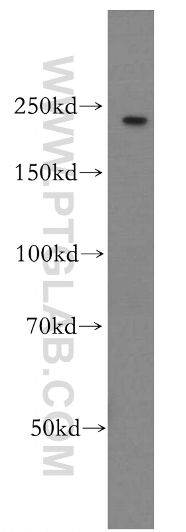 PI4KA Antibody in Western Blot (WB)