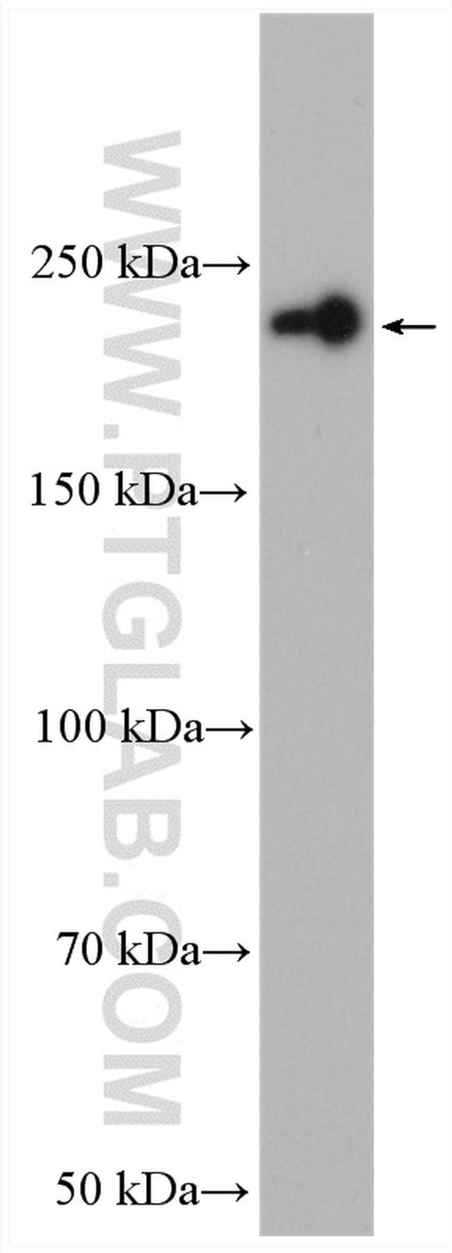 PI4KA Antibody in Western Blot (WB)