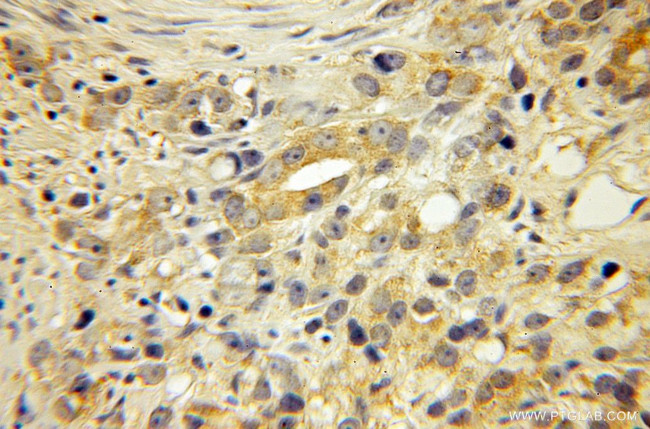 EDF1 Antibody in Immunohistochemistry (Paraffin) (IHC (P))