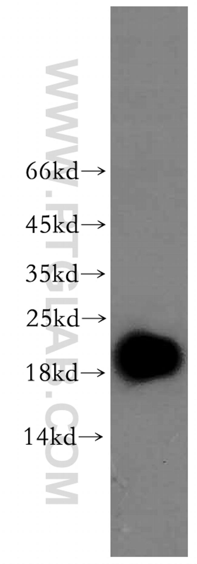 EDF1 Antibody in Western Blot (WB)