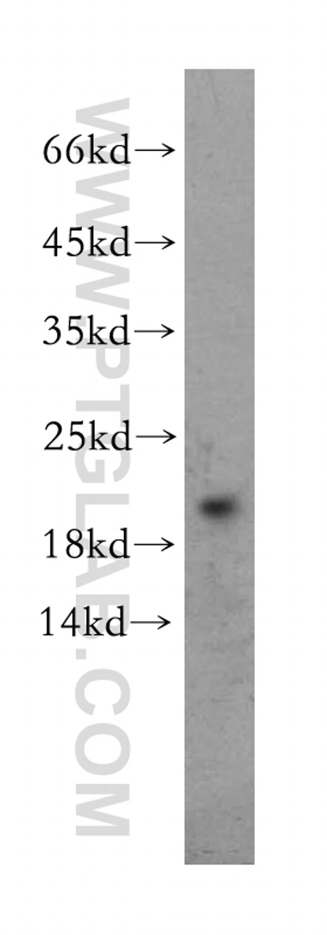 EDF1 Antibody in Western Blot (WB)