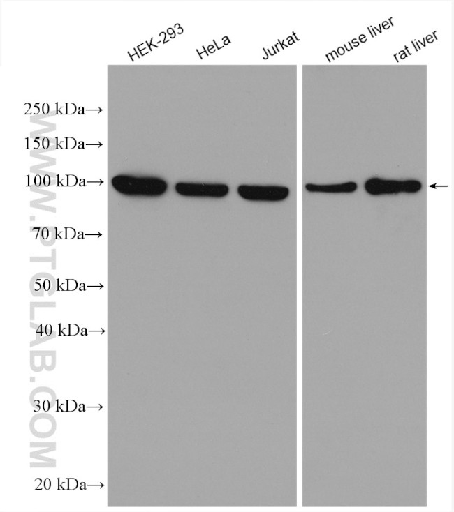 PDCD6IP Antibody in Western Blot (WB)