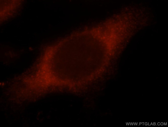 PDCD6IP Antibody in Immunocytochemistry (ICC/IF)