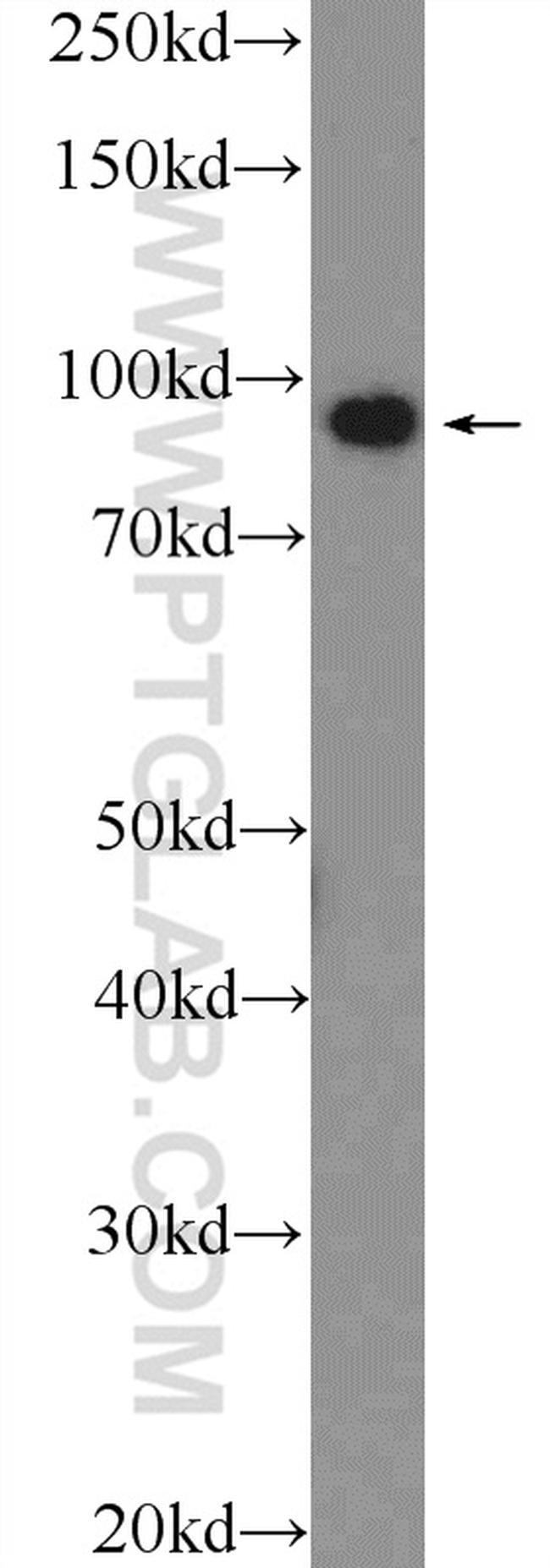 PDCD6IP Antibody in Western Blot (WB)