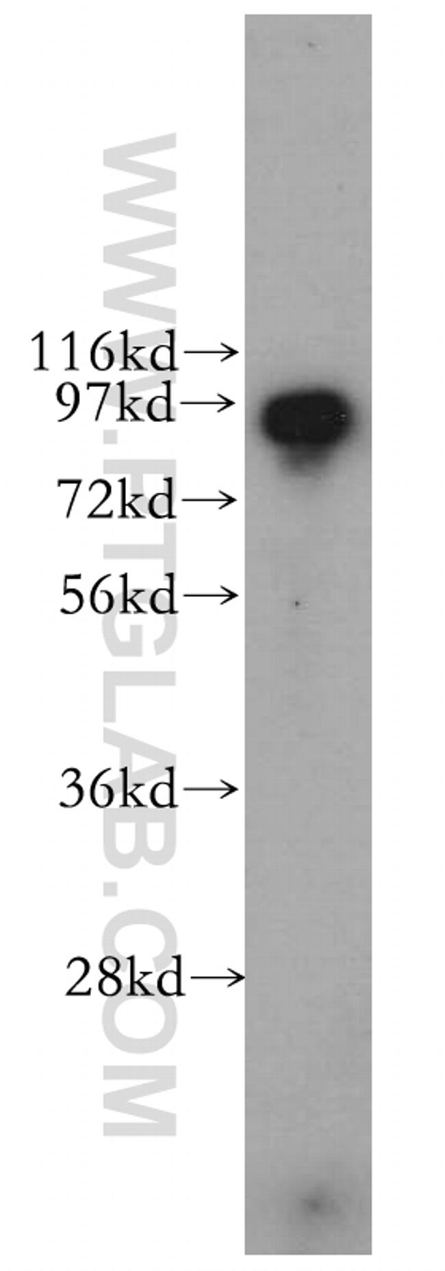 PDCD6IP Antibody in Western Blot (WB)