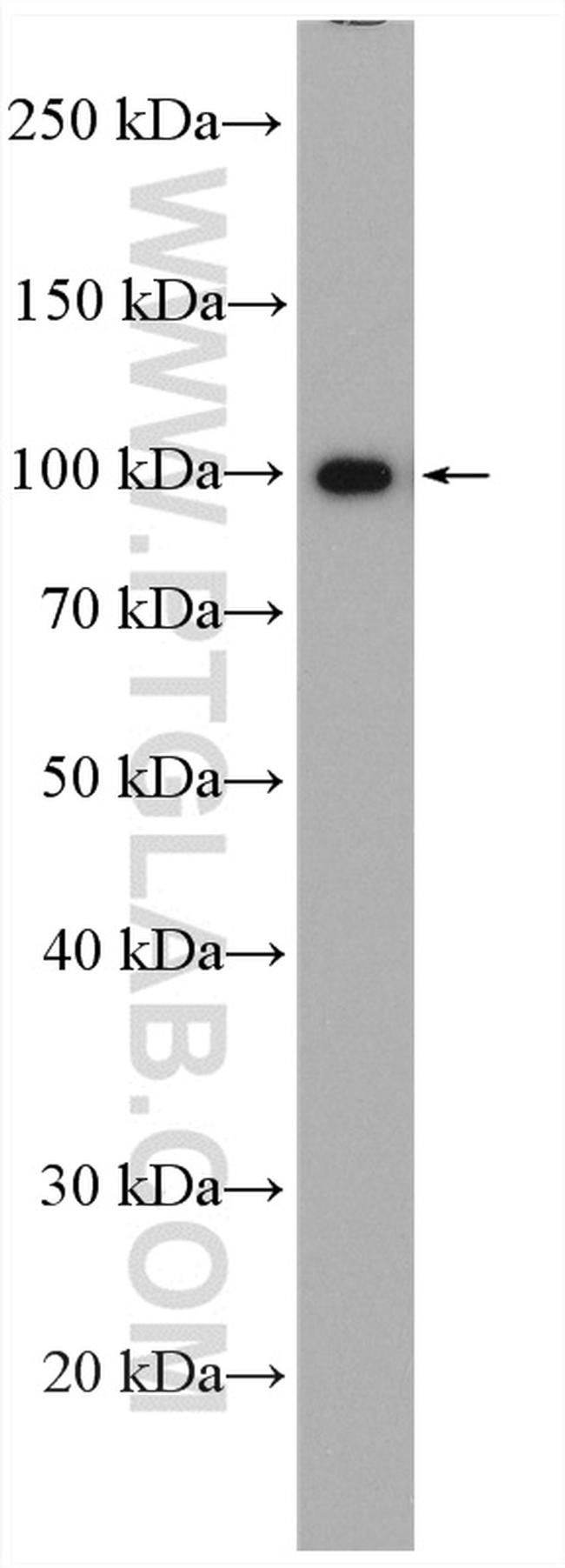 PDCD6IP Antibody in Western Blot (WB)