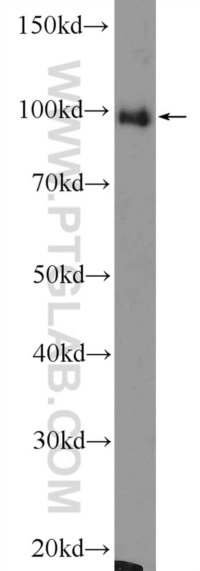 PDCD6IP Antibody in Western Blot (WB)