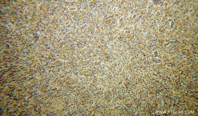 SLC20A1 Antibody in Immunohistochemistry (Paraffin) (IHC (P))