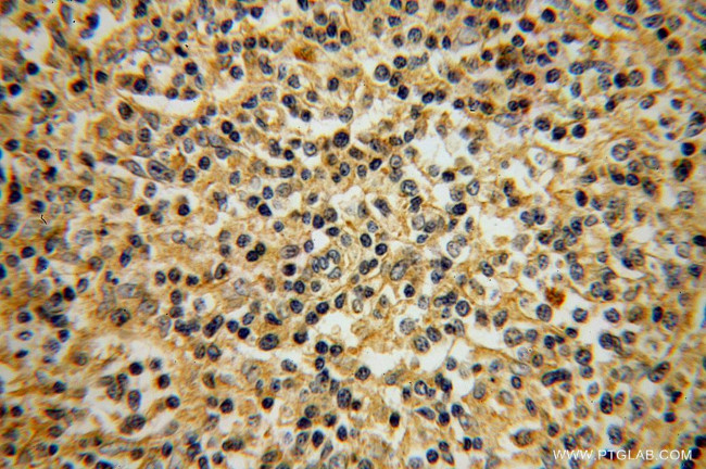 SLC20A1 Antibody in Immunohistochemistry (Paraffin) (IHC (P))