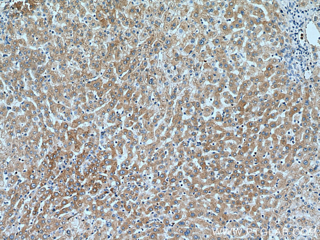 SLC20A1 Antibody in Immunohistochemistry (Paraffin) (IHC (P))