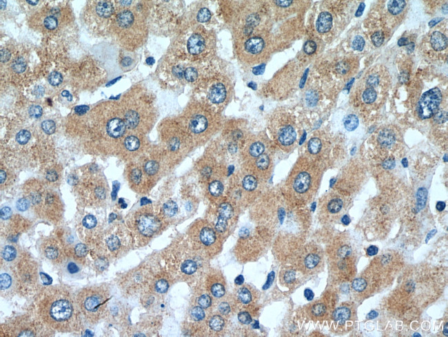 SLC20A1 Antibody in Immunohistochemistry (Paraffin) (IHC (P))