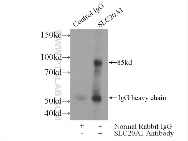 SLC20A1 Antibody in Immunoprecipitation (IP)