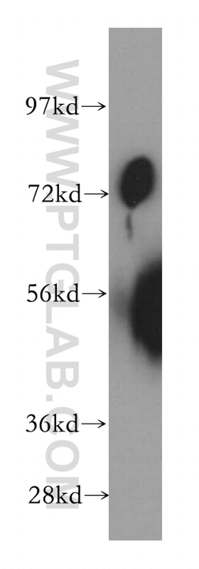 SLC20A1 Antibody in Western Blot (WB)