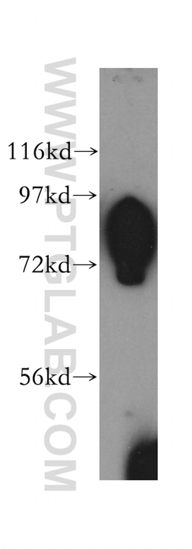 SLC20A1 Antibody in Western Blot (WB)