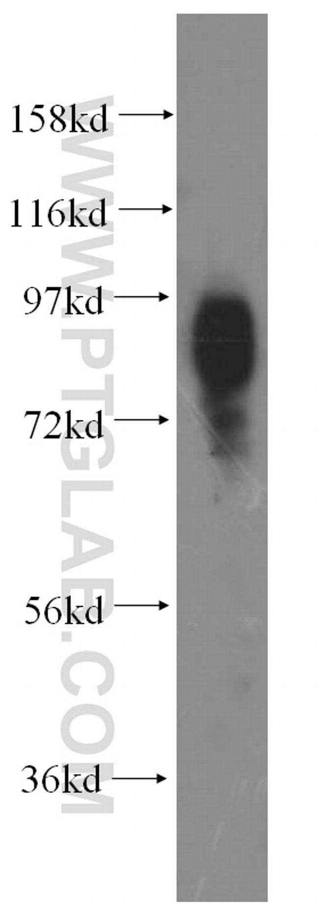 SLC20A1 Antibody in Western Blot (WB)