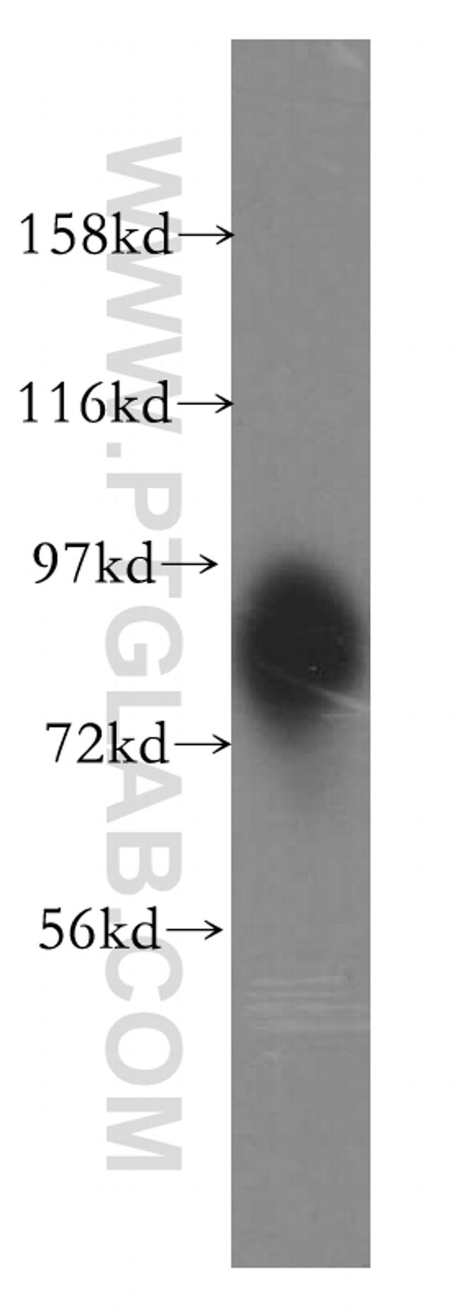 SLC20A1 Antibody in Western Blot (WB)